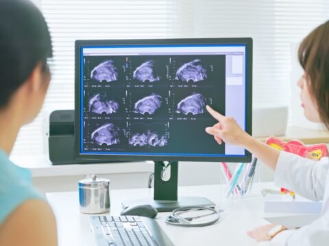 AI detects ovarian cancer better than human experts in new study